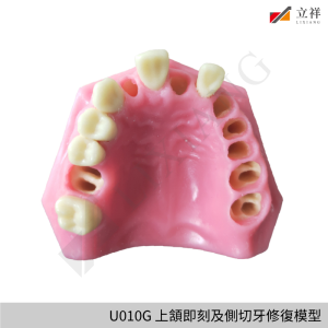 U010G 上頷即刻及側切牙修復模型