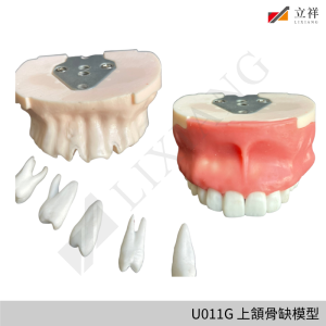 U011G 上頷骨缺模型